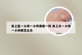 身上起一小块一小块像癣一样 身上长一小块一小块癣怎么办