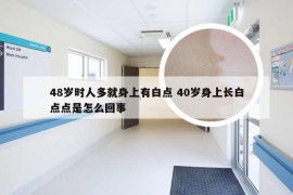 48岁时人多就身上有白点 40岁身上长白点点是怎么回事