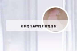 肝癣是什么样的 肝胗是什么