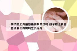 孩子脸上真菌感染会长白斑吗 孩子脸上真菌感染会长白斑吗怎么治疗