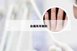 白癜风早期的