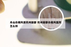 舟山白癜风属杭州丽都 杭州丽都白瘢风医院怎么样