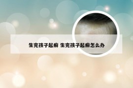 生完孩子起癣 生完孩子起癣怎么办