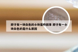 脖子有一块白色的小块是咋回事 脖子有一小块白色的是什么原因