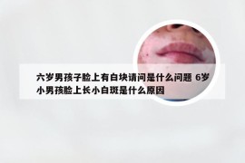 六岁男孩子脸上有白块请问是什么问题 6岁小男孩脸上长小白斑是什么原因