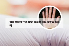 银屑病能考什么大学 银屑病可以报考公务员吗