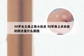 50岁女士身上有小白点 50岁身上长白色的斑点是什么原因