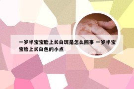 一岁半宝宝脸上长白斑是怎么回事 一岁半宝宝脸上长白色的小点