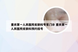 重庆第一人民医院皮肤科专家门诊 重庆第一人民医院皮肤科预约挂号