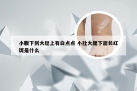 小腹下到大腿上有白点点 小肚大腿下面长红斑是什么