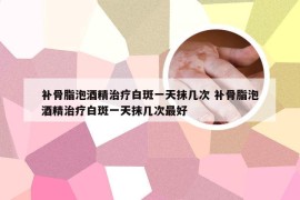 补骨脂泡酒精治疗白斑一天抹几次 补骨脂泡酒精治疗白斑一天抹几次最好