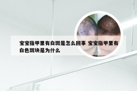 宝宝指甲里有白斑是怎么回事 宝宝指甲里有白色斑块是为什么