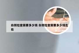 白斑检查需要多少钱 白斑检查需要多少钱左右