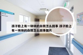 孩子脸上有一块块的白斑怎么回事 孩子脸上有一块块的白斑怎么回事图片