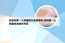 杭州市第一人民医院牛皮癣专科 杭州第一人民医院皮肤科专家