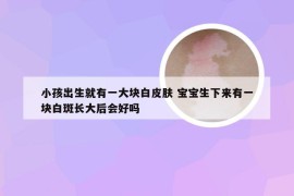 小孩出生就有一大块白皮肤 宝宝生下来有一块白斑长大后会好吗