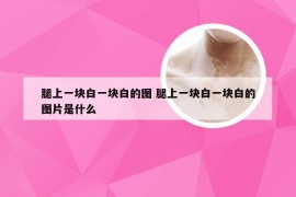 腿上一块白一块白的图 腿上一块白一块白的图片是什么