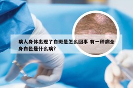 病人身体出现了白斑是怎么回事 有一种病全身白色是什么病?