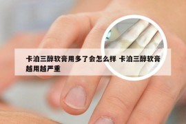 卡泊三醇软膏用多了会怎么样 卡泊三醇软膏越用越严重