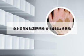 身上局部皮肤发硬粗糙 身上皮肤块状粗糙