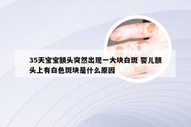 35天宝宝额头突然出现一大块白斑 婴儿额头上有白色斑块是什么原因