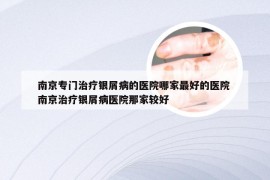 南京专门治疗银屑病的医院哪家最好的医院 南京治疗银屑病医院那家较好