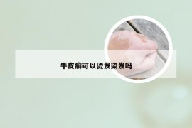 牛皮癣可以烫发染发吗