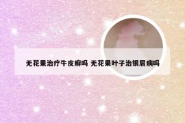 无花果治疗牛皮癣吗 无花果叶子治银屑病吗