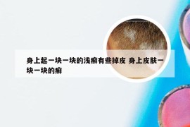 身上起一块一块的浅癣有些掉皮 身上皮肤一块一块的癣