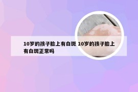 10岁的孩子脸上有白斑 10岁的孩子脸上有白斑正常吗