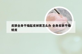 皮肤全身干燥起皮掉屑怎么办 全身皮肤干燥蜕皮