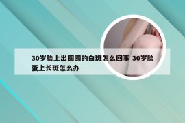 30岁脸上出圆圆的白斑怎么回事 30岁脸蛋上长斑怎么办