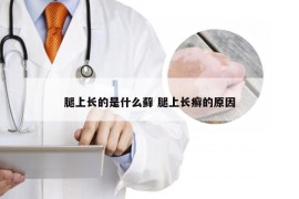 腿上长的是什么藓 腿上长癣的原因