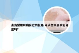 点滴型银屑病自愈的征兆 点滴型银屑病能自愈吗?