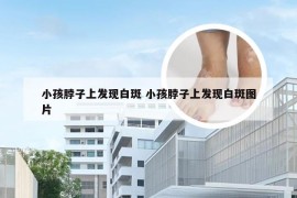 小孩脖子上发现白斑 小孩脖子上发现白斑图片