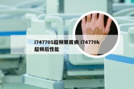 i74770S超频银屑病 i74770k超频后性能