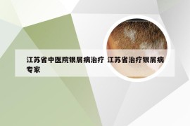 江苏省中医院银屑病治疗 江苏省治疗银屑病专家