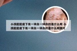 小孩屁屁底下有一块白一块白的是什么呢 小孩屁屁底下有一块白一块白的是什么呢图片