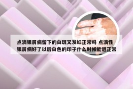 点滴银屑病留下的白斑又发红正常吗 点滴性银屑病好了以后白色的印子什么时候能退正常