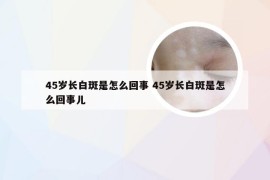 45岁长白斑是怎么回事 45岁长白斑是怎么回事儿