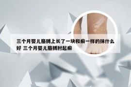 三个月婴儿胳膊上长了一块和癣一样的抹什么好 三个月婴儿胳膊肘起癣