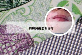 白癜风要怎么治疗