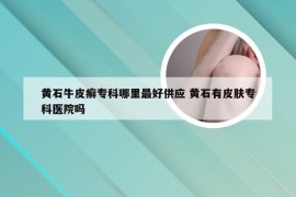 黄石牛皮癣专科哪里最好供应 黄石有皮肤专科医院吗