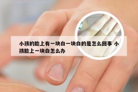 小孩的脸上有一块白一块白的是怎么回事 小孩脸上一块白怎么办