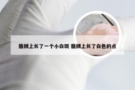 胳膊上长了一个小白斑 胳膊上长了白色的点