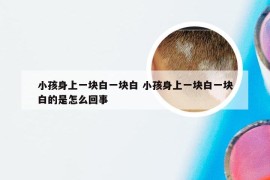 小孩身上一块白一块白 小孩身上一块白一块白的是怎么回事