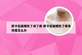 脖子后面晒伤了成了癣 脖子后面晒伤了痒有疙瘩怎么办