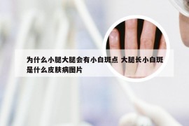 为什么小腿大腿会有小白斑点 大腿长小白斑是什么皮肤病图片