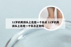 11岁的男孩头上出现一个白点 11岁的男孩头上出现一个白点正常吗