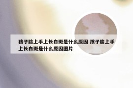 孩子脸上手上长白斑是什么原因 孩子脸上手上长白斑是什么原因图片